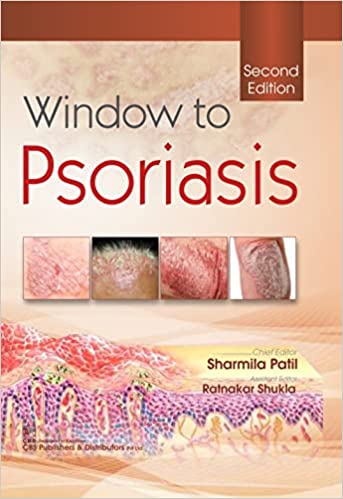 Window To Psoriasis 2nd Edition 2021 By Patil S