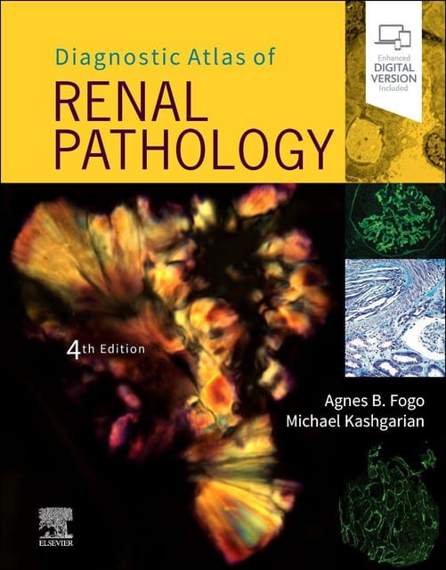 Diagnostic Atlas of Renal Pathology 4th Edition 2022 By Fogo