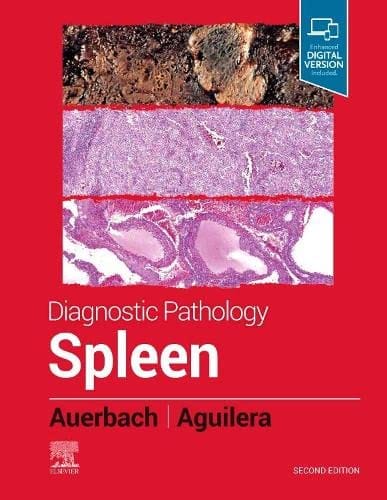 Diagnostic Pathology: Spleen 2nd Edition 2022 By Auerbach