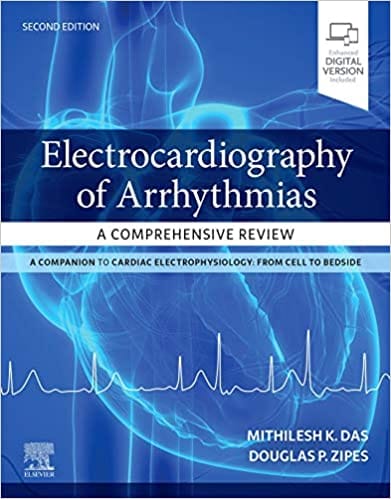 Electrocardiography of Arrhythmias: A Comprehensive Review 2nd Edition 2021 By Das