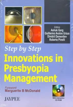 Step By Step Innovations In Presbyopia Management With Cd-Rom 1st Edition 2006 By Ashok Garg