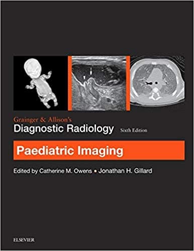 Grainger & Allison?s Diagnostic Radiology Paediatric Imaging 2015 By Owens