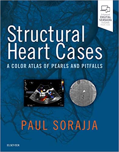 Structural Heart Cases A Color Atlas Of Pearls And Pitfalls With Access Code 2019 By Sorajja P