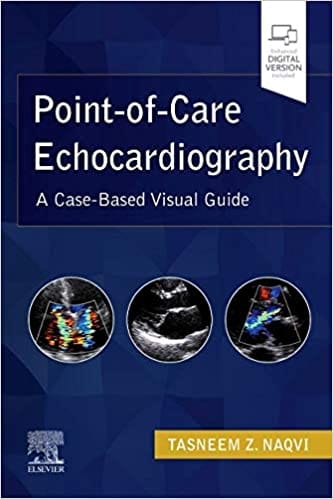 Point Of Care Echocardiography A Case Based Visual Guide 2022 By Naqvi T Z