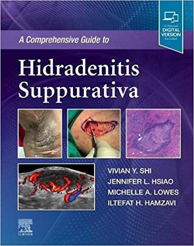 A Comprehensive Guide To Hidradenitis Suppurativa With Access Code 2022 By Shi V Y