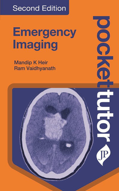 Pocket Tutor Emergency Imaging 2nd Edition 2022 By Mandip K Heir & Ram Vaidhyanath