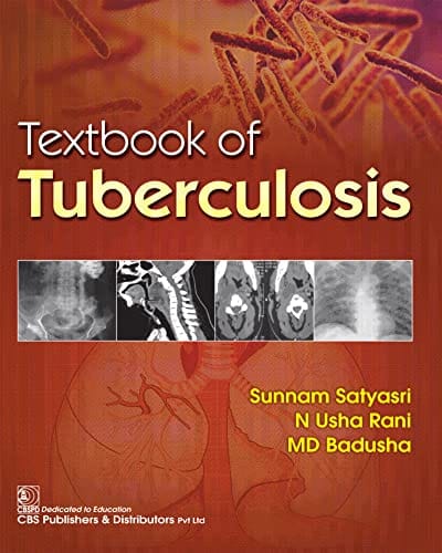 Textbook Of Tuberculosis 2022 By Satyasri S