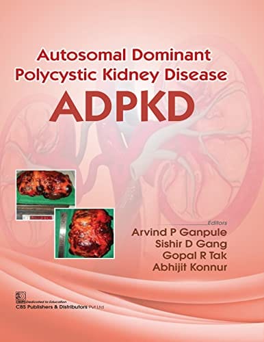 Autosomal Dominant Polycystic Kidney Disease Adpkd 2022 By Ganpule A P