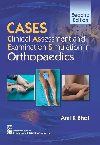 Cases Clinical Assessment And Examination Simulation In Orthopaedics 2nd Edition 2022 By Anil K Bhat