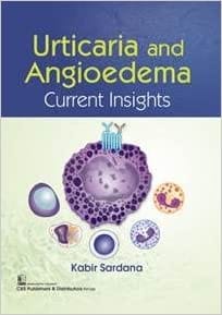 Urticaria And Angioedema Current Insights 2022 By Sardana K