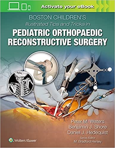 Boston Childrens Illustrated Tips And Tricks In Pediatric Orthopaedic Reconstructive Surgery 2022 By Waters P M