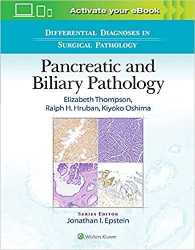 Differential Diagnoses In Surgical Pathology Pancreatic And Biliary Pathology 2022 By Thompson E D