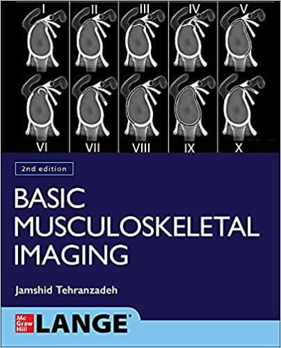 Basic Musculoskeletal Imaging 2nd Edition 2021 By Tehranzadeh J