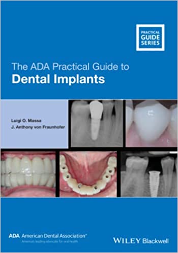 The Ada Practical Guide To Dental Implants 2021 By Massa L O