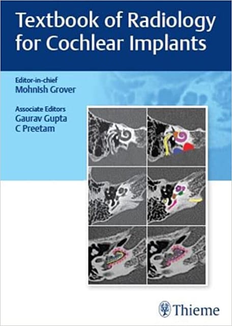 Textbook Of Radiology For Cochlear Implants 2022 By Grover M
