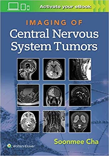 Imaging Of Central Nervous System Tumors With Access Code 2022 By Cha S