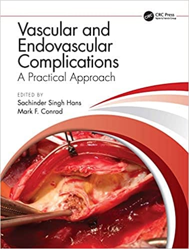 Vascular And Endovascular Complications A Practical Approach 2021 By Hans S S