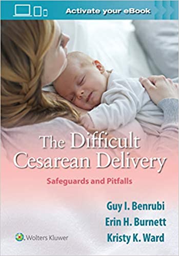 The Difficult Cesarean Delivery Safeguards And Pitfalls 2021 By Benrubi G I