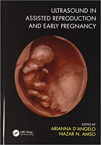 Ultrasound In Assisted Reproduction And Early Pregnancy With Access Code 2021 By D'Angelo A