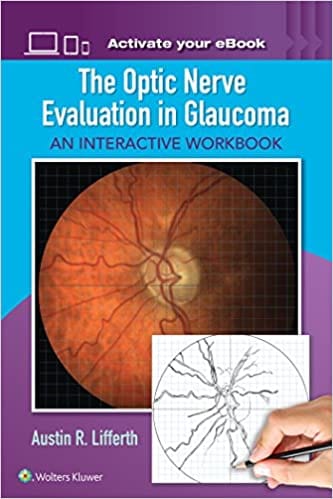 The Optic Nerve Evaluation in Glaucoma An Interactive Workbook 2017 By Lifferth