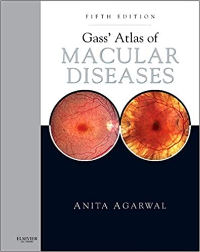Gass Atlas of Macular Diseases 5th Edition 2011 Set of 2 Volumes By Agarwal