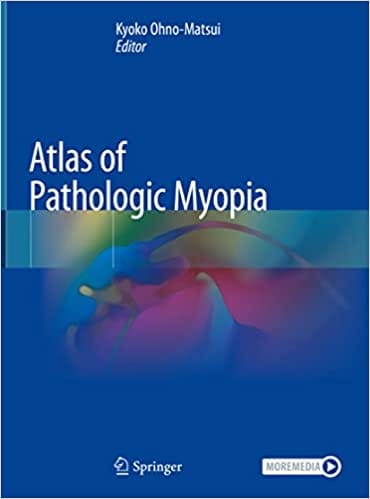 Atlas Of Pathologic Myopia 1st Edition 2020 By Pjmp-Matsui K