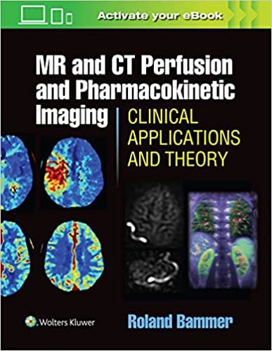 Mr And Ct Perfusion And Pharmacokinetic Imaging Clinical Applications And Theory 2016 By Bammer R