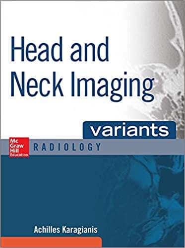 Head And Neck Imaging Variants Radiology 2016 By Karagianis A