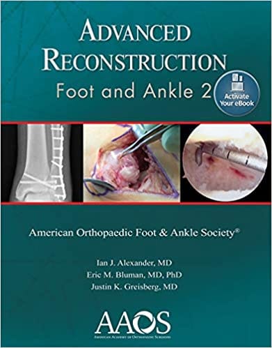 Advanced Reconstruction Foot And Ankle 2 2015 By Alexander I J