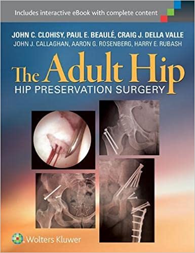 The Adult Hip Hip Preservation Surgery 2015 By Clohisy J C