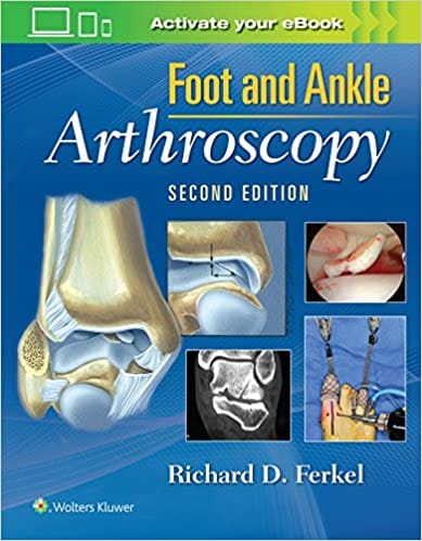 Foot And Ankle Arthroscopy 2nd Edition 2017 By Ferkel R D