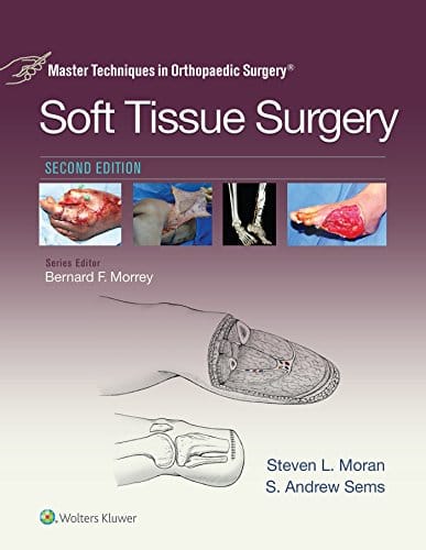 Master Techniques In Orthopaedic Surgery Soft Tissue Surgery 2nd Edition 2017 By Moran S L