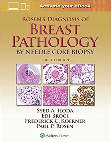 Rosens Diagnosis Of Breast Pathology By Needle Core Biopsy 4th Edition 2017 By Hoda S A