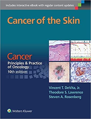 Cancer Of The Skin Cancer Principles And Practice Of Oncology 10th Edition 2016 By Devita V T