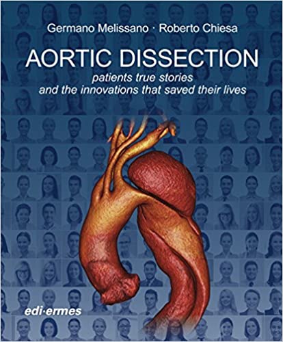 Aortic Dissection Patients True Stories And The Innovations That Saved Their Lives 2016 By Melissano G