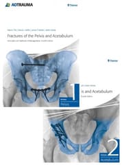 Fractures Of The Pelvis And Acetabulum Principles And Methods Of Management 4th Edition 2 Vol Set 2018 By Tile M