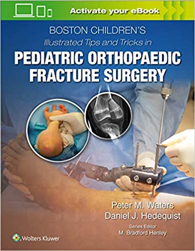Boston Childrens Illustrated Tips And Tricks In Pediatric Orthopaedic Fracture Surgery 2020 By Waters P M