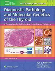 Diagnostic Pathology And Molecular Genetics Of The Thyroid A Comprehensive Guide For Practicing Thyroid Pathology 3rd Edition 2020 By Nikiforov Y E