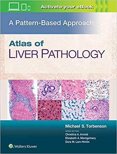 Atlas Of Liver Pathology A Pattern Based Approach 2020 By Torbenson M S