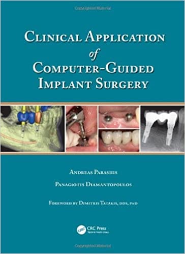 Clinical Application Of Computer Guided Implant Surgery 2019 By Parashis A