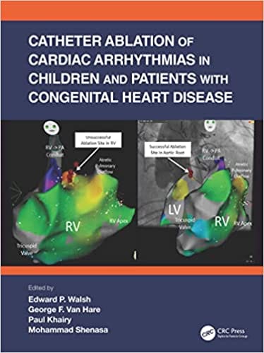 Catheter Ablation Of Cardiac Arrhythmias In Children And Pathients With Congenital Heart Disease 2022 By Walsh E P