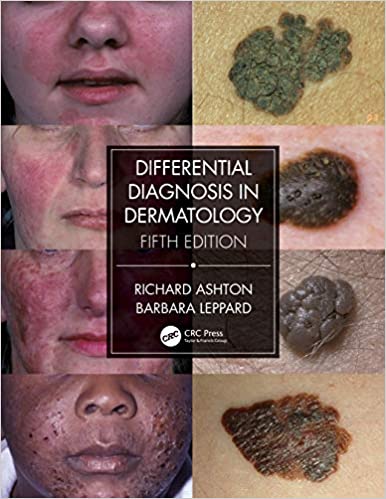Differential Diagnosis In Dermatology 5th Edition 2021 By Ashton R