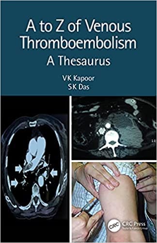 A To Z Of Venous Thromboembolism A Thesaurus 2nd Edition 2021 By Kapoor V K
