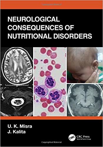 Neurological Consequences Of Nutritional Disorders 2021 By Misra U K
