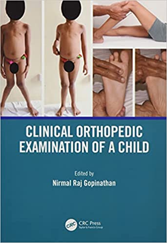 Clinical Orthopedic Examination Of A Child 2021 By Gopinathan N R