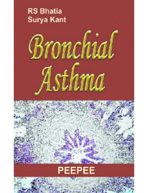 Bronchial Asthma 1st Edition 2008 By Rs Bhatia