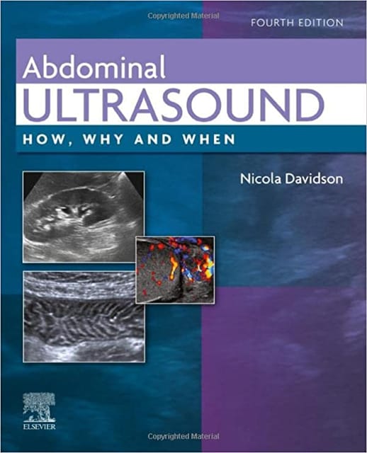 Abdominal Ultrasound 4th Edition 2022 By Davidson