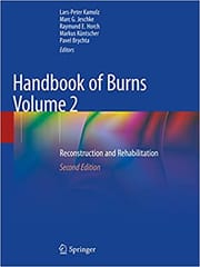 Kamolz L P Handbook Of Burns Volume 2 Reconstruction And Rehabilitation 2nd Edition 2020