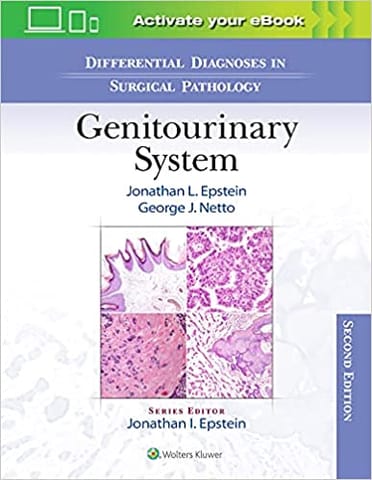 Epstein J I Differential Diagnoses In Surgical Pathology Genitourinary