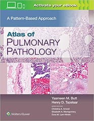 Butt Y M Atlas Of Pulmonary Pathology A Pattern Based Approach With Access Code 2021